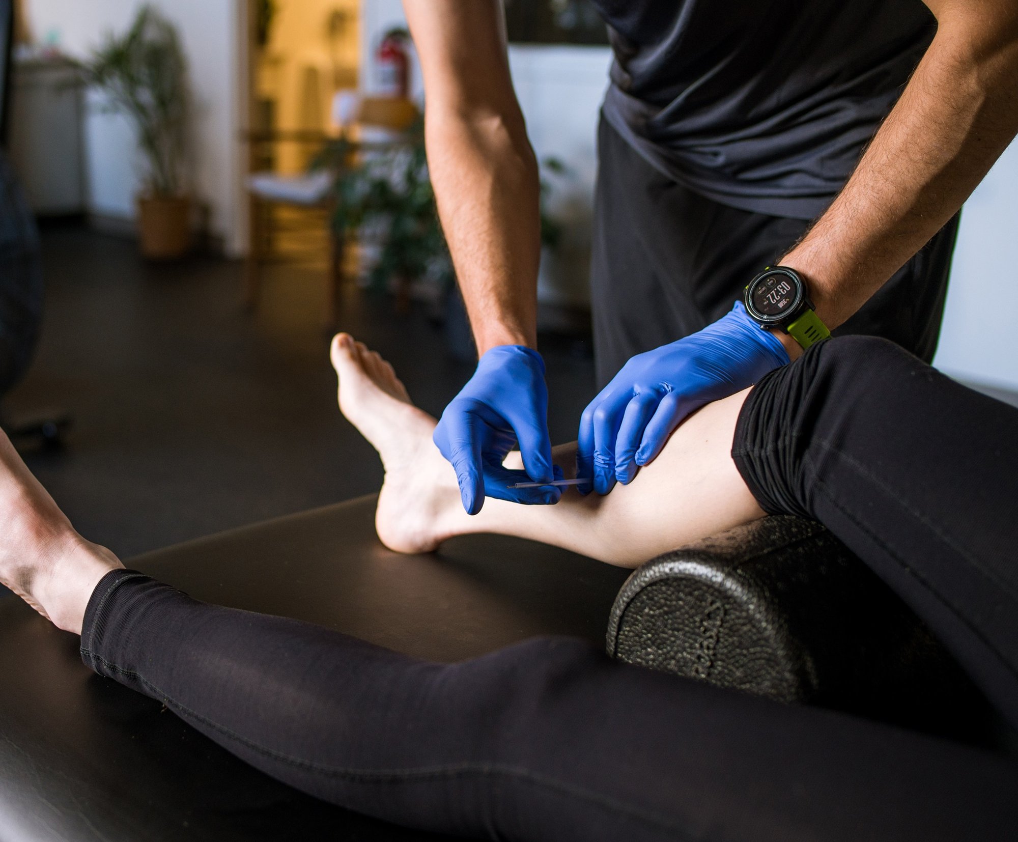A Portland Maine Physical Therapist performing dry needling on a runner.