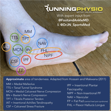 An infographic of different causes of plantar heel pain by Tom Goom the Running Physio