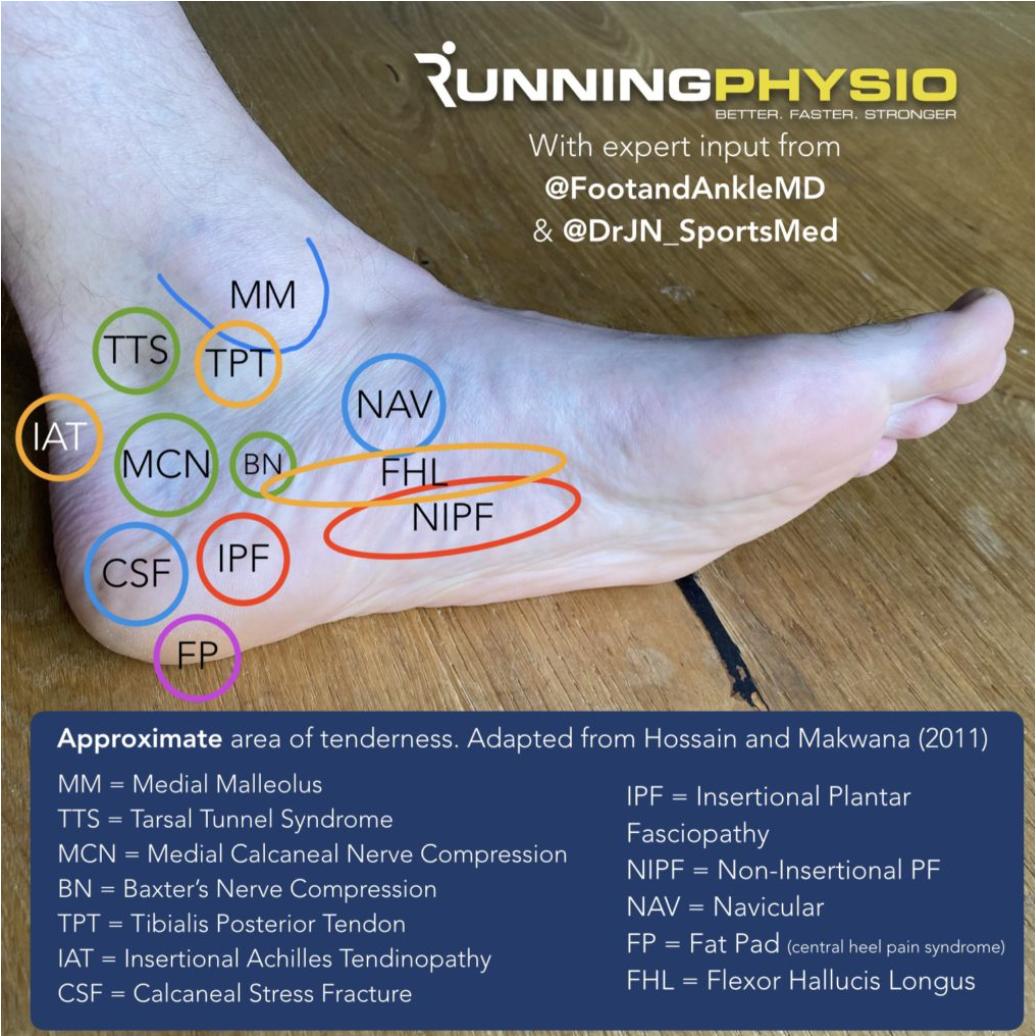 An infographic on different causes of plantar heel pain by Tom Goom Running Physio