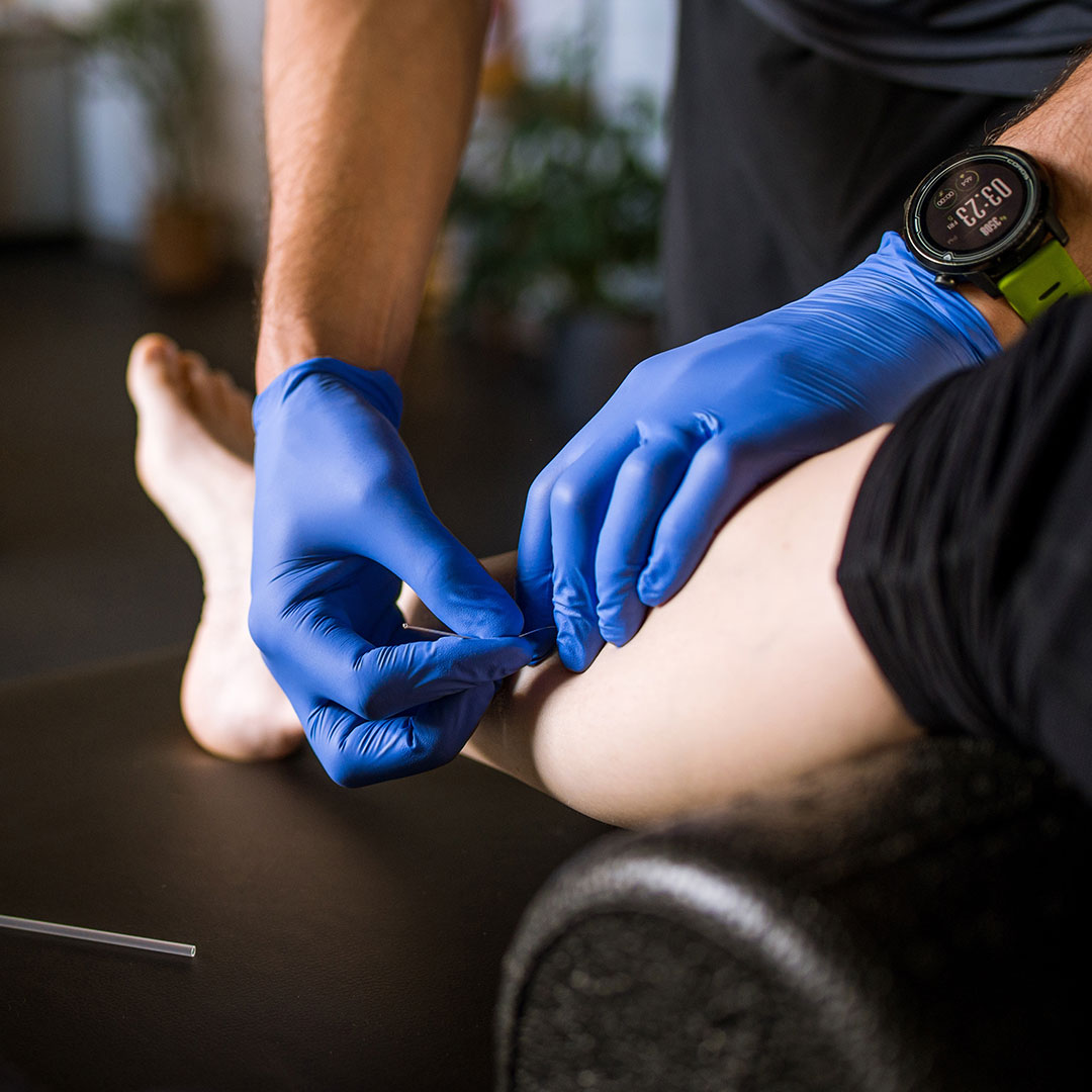 Dr Kelton Cullenberg giving a patient dry needling therapy on their calf